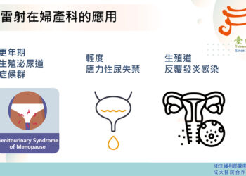 陰道雷射不只是醫美！　更是治療更年期生殖泌尿症候群新選擇
