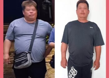 男子恍神又嗜睡   就醫才發現肥胖導致胰島素分泌失調