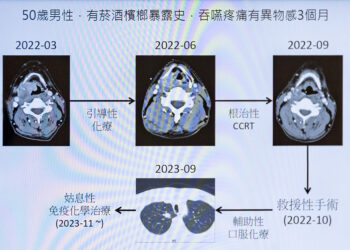 治療晚期下咽癌選擇 醫病共享決策提升品質