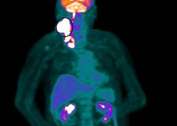 健保也能創造奇蹟 80歲癌末患者放射治療逆轉困境